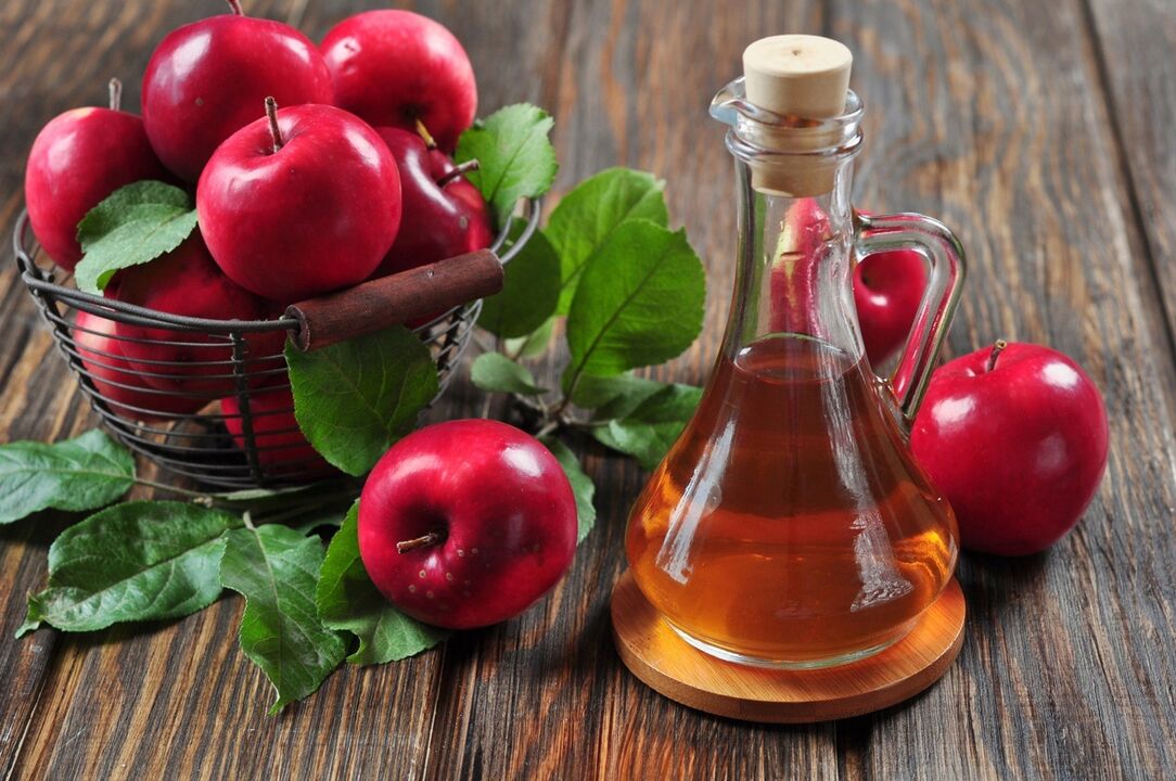Cuka cider epal untuk rawatan berkesan vena varikos