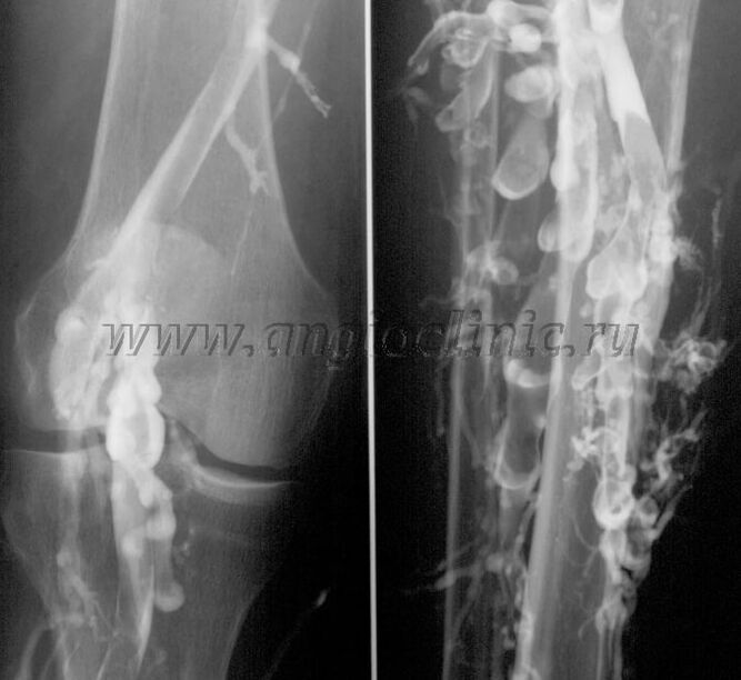 Pengimbasan ultrabunyi